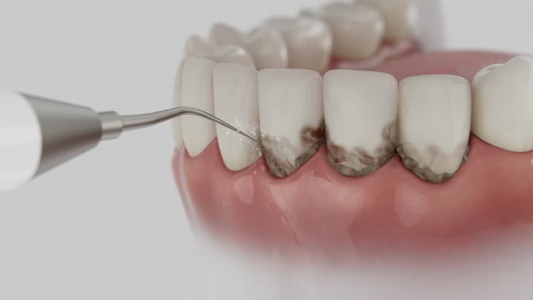 Trusted Emergency Dentist service in Hamlin, WV - Dentist Open Now